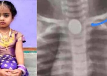 ಪ್ರಾಣ ತೆಗೆದ ಐದು ರೂಪಾಯಿ ನಾಣ್ಯ