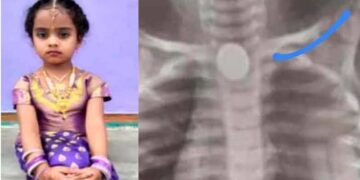 ಪ್ರಾಣ ತೆಗೆದ ಐದು ರೂಪಾಯಿ ನಾಣ್ಯ