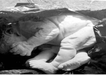 ಮಗುವನ್ನ ಬಿಸುಟಿದ್ದ ಅನಾಮಿಕರು: ಸಂಸ್ಕಾರ ನಡೆಸಿದ ಪೊಲೀಸರು