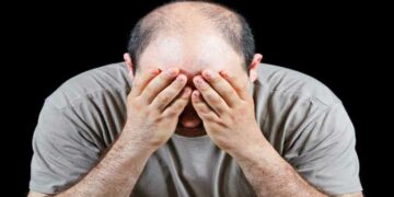Health: ಪುರುಷರ ಬಕ್ಕತಲೆಗೆ ಮುಖ್ಯ ಕಾರಣಗಳು ಹಾಗೂ ತಡೆಯಲು ಸೂಕ್ತ ಪರಿಹಾರಗಳು