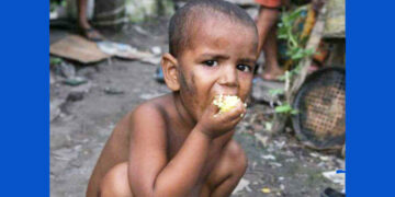 Malnutrition: ಭಾರತದಲ್ಲಿ 33 ಲಕ್ಷ ಮಕ್ಕಳಲ್ಲಿ ಅಪೌಷ್ಟಿಕತೆ: ಆರ್‌ಟಿಐ ಅಡಿ ಮಾಹಿತಿ ಬಹಿರಂಗ