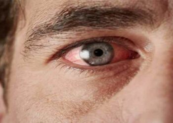 Diabetic Retinopathy